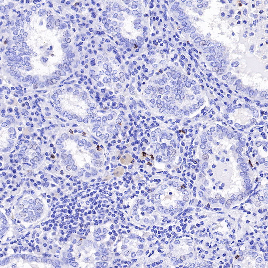 LAG3 Recombinant Rabbit mAb (SDT-R159)