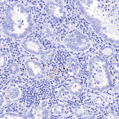 LAG3 Recombinant Rabbit mAb (SDT-R159)