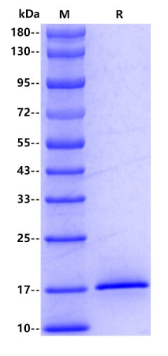 Human LECT2, His tag