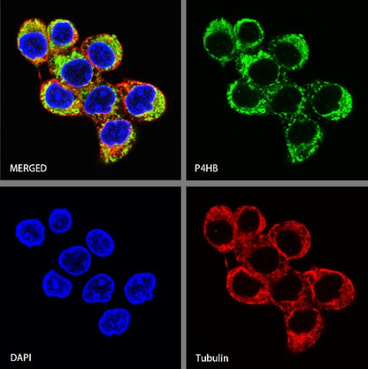 P4HB Recombinant Rabbit mAb (S-1524-120)