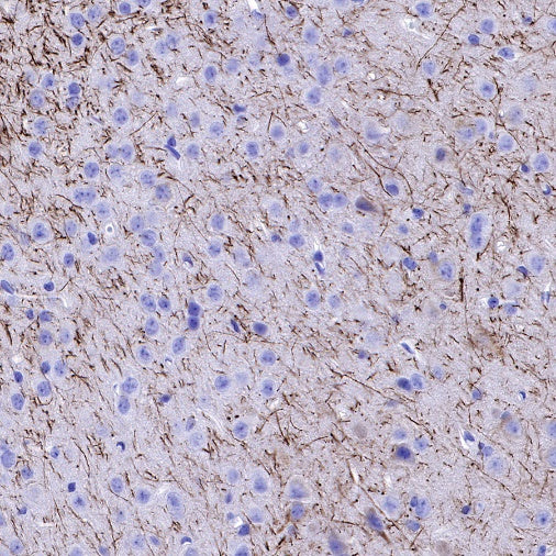 Neurofilament H Recombinant Rabbit mAb (S-532-103)