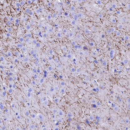 Neurofilament H Recombinant Rabbit mAb (S-532-103)