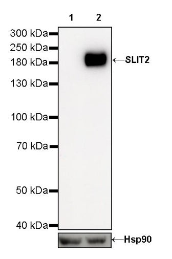 SLIT2 Recombinant Rabbit mAb (S-730-41)