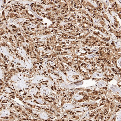 PSMB5 Rabbit Polyclonal Antibody