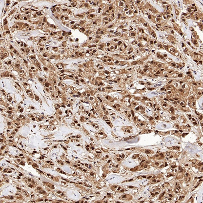 PSMB5 Rabbit Polyclonal Antibody