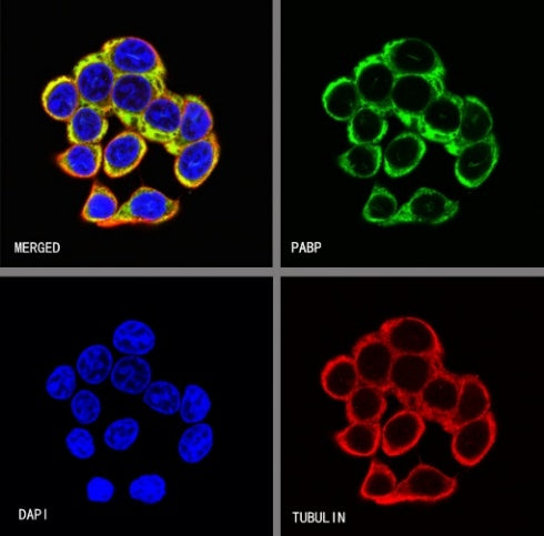 PABP Recombinant Rabbit mAb (S-1744-42)