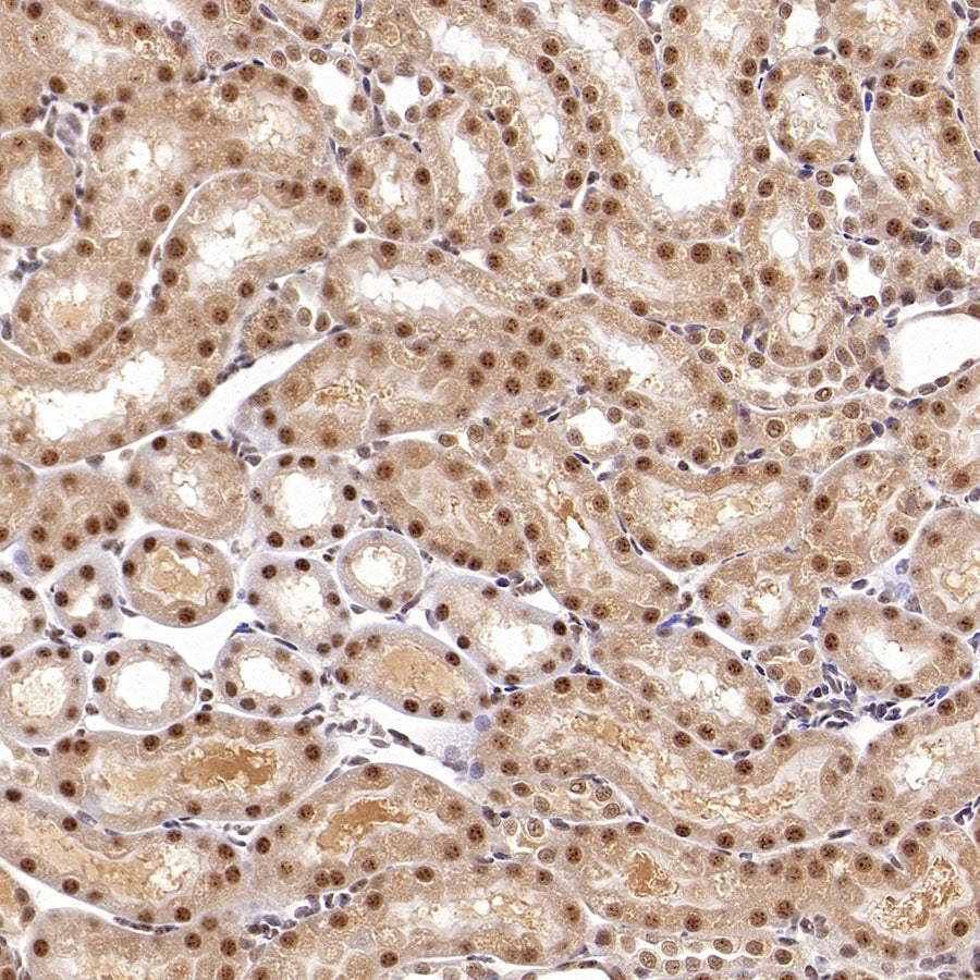 USP5 Rabbit Polyclonal Antibody