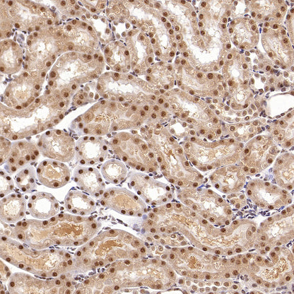 USP5 Rabbit Polyclonal Antibody