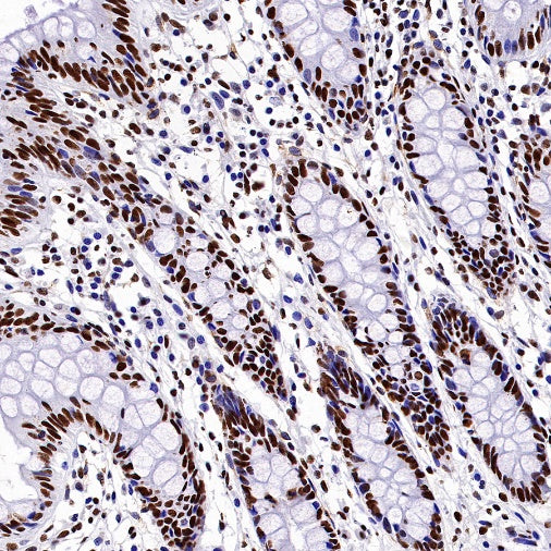 Nucleolin Rabbit Polyclonal Antibody