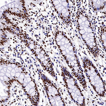 Nucleolin Rabbit Polyclonal Antibody
