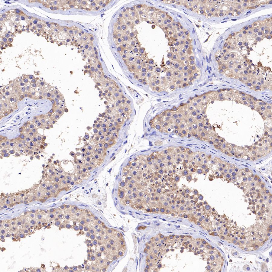 ATG7 Recombinant Rabbit mAb (S-1279-201)
