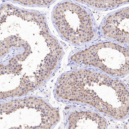 ATG7 Recombinant Rabbit mAb (S-1279-201)