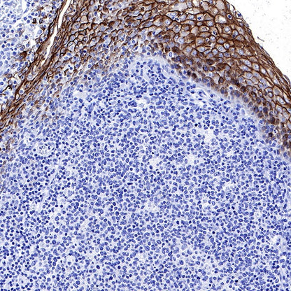 S-RMab® MUC1/EMA Recombinant Rabbit mAb (SDT-776-49)