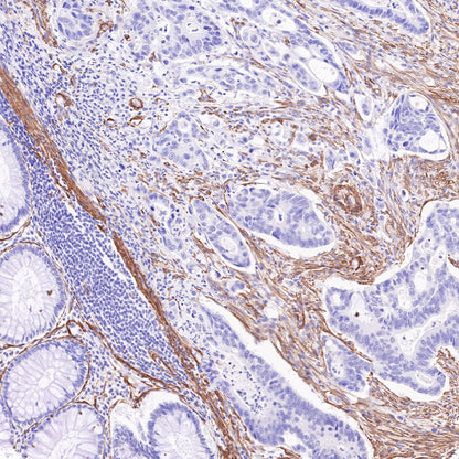 alpha smooth muscle Actin Recombinant Mouse mAb (SDT-R142)