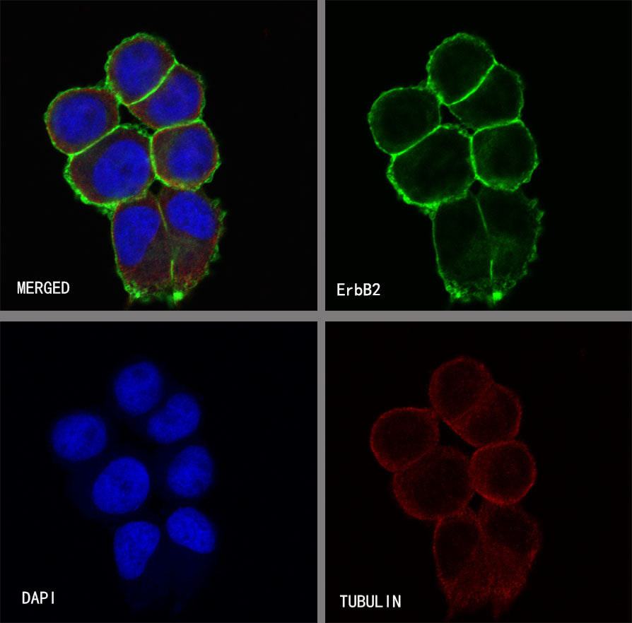 S-RMab® ErbB2 Recombinant Rabbit mAb (SDT-069-57)
