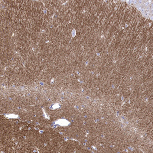 Cortactin Recombinant Rabbit mAb (S-1303-10)