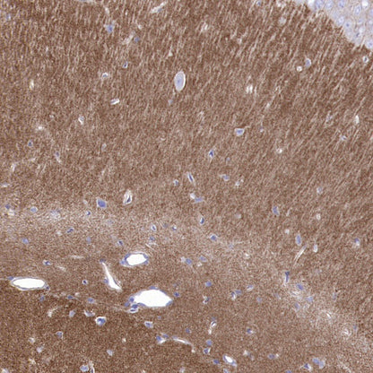 Cortactin Recombinant Rabbit mAb (S-1303-10)