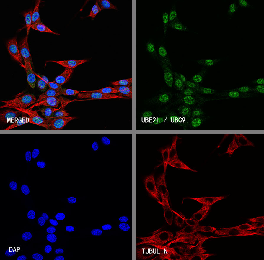 UBE2I / UBC9 Rabbit Polyclonal Antibody