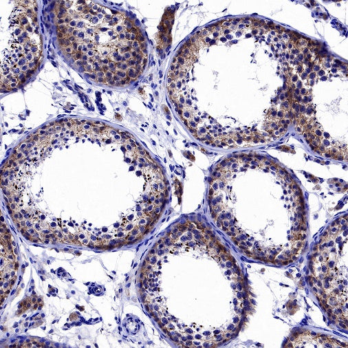 Cortactin Recombinant Rabbit mAb (S-1303-10)