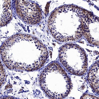 Cortactin Recombinant Rabbit mAb (S-1303-10)