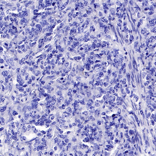 S-RMab® FGFR2b Recombinant Rabbit mAb (SDT-423-33)
