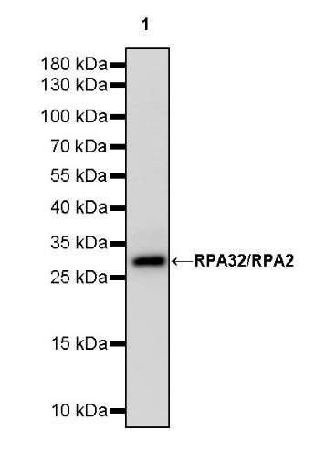 RPA32/RPA2 Rabbit Polyclonal Antibody