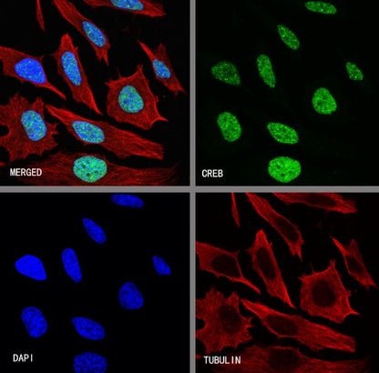 CREB Recombinant Rabbit mAb (S-1115-39)