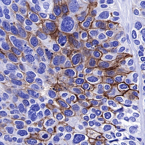 Carbonic Anhydrase 9 Recombinant Rabbit mAb (SDT-733-28)