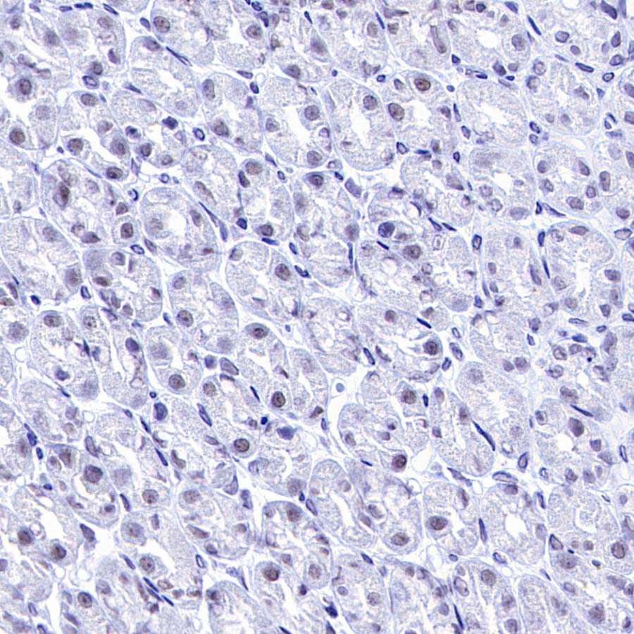DGCR8 Recombinant Rabbit mAb (S-4082-6)