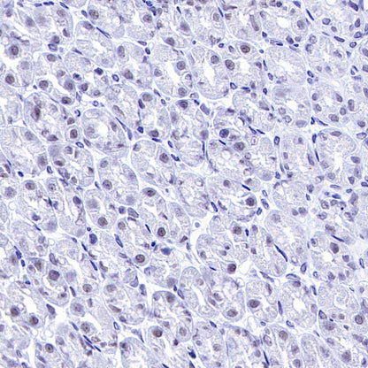 DGCR8 Recombinant Rabbit mAb (S-4082-6)