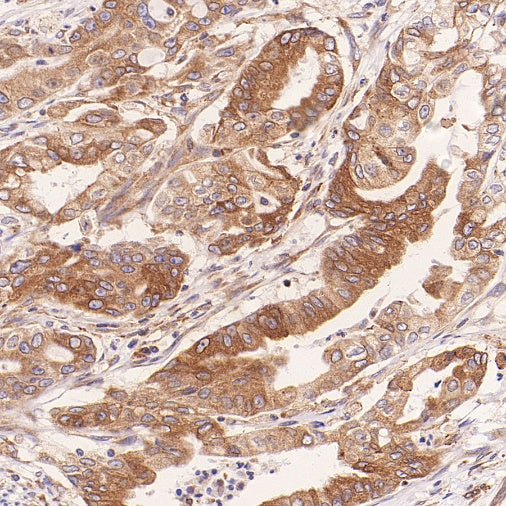 TUBA1B Rabbit Polyclonal Antibody