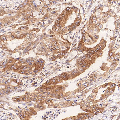 TUBA1B Rabbit Polyclonal Antibody