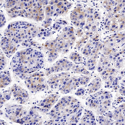 AAT Recombinant Rabbit mAb (S-943-37)