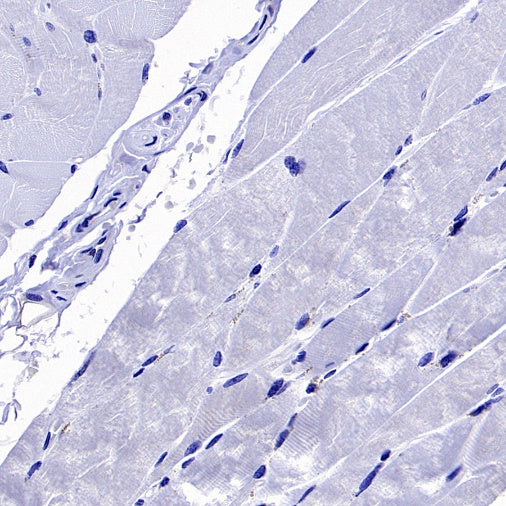 PPIA Recombinant Rabbit mAb (S-2406-28)