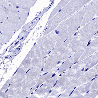 PPIA Recombinant Rabbit mAb (S-2406-28)