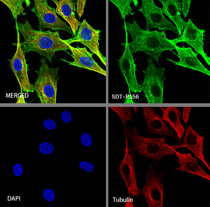 β-actin Recombinant Rabbit mAb (SDT-R156)
