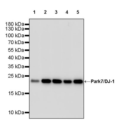 Park7/DJ-1 Recombinant Rabbit mAb (S-980-144)