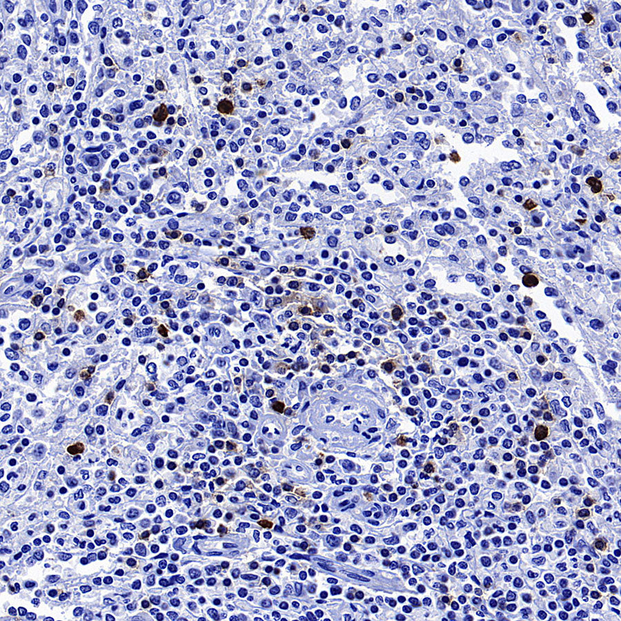 CD127 Recombinant Rabbit mAb (S-4826)