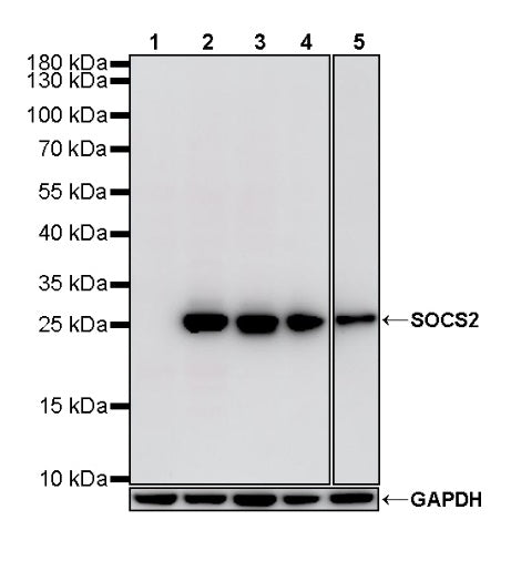 SOCS2 Recombinant Rabbit mAb (S-4956-21)