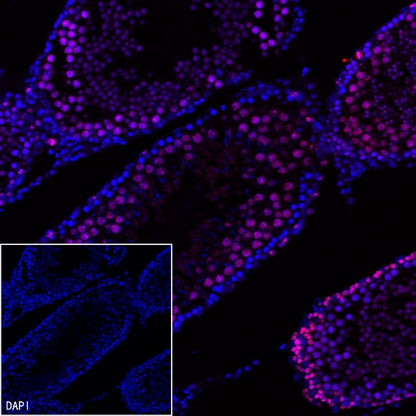 Ki67 Recombinant Rabbit mAb (Alexa Fluor® 555 Conjugate) (SDT-R459)