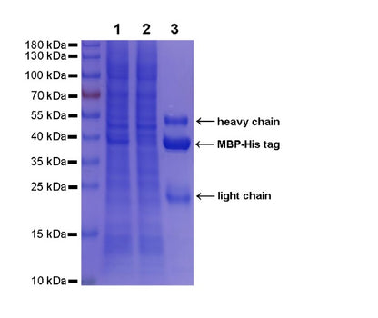 Rabbit Anti-His Tag (C-terminal) Magnetic Agarose