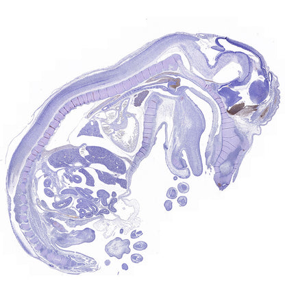 FOXG1 Recombinant Rabbit mAb (S-5244)