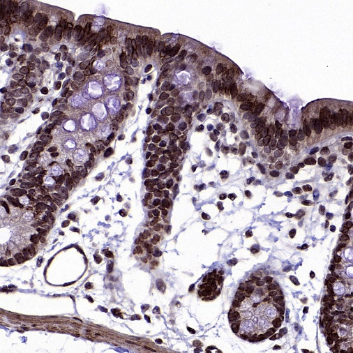 MBD3 Rabbit Polyclonal Antibody
