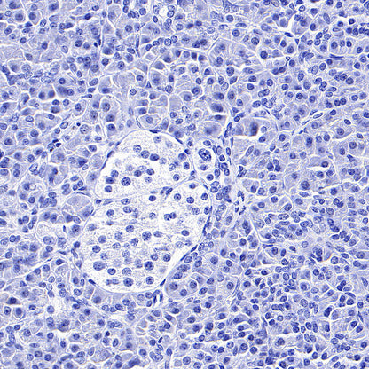 MCT1/Monocarboxylic acid transporter 1 Recombinant Rabbit mAb (S-5144)