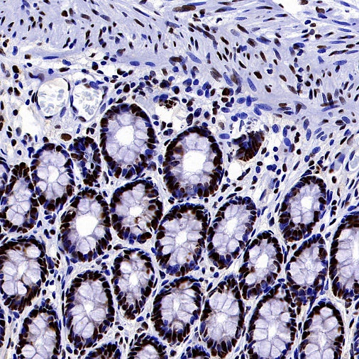 HAT1 Recombinant Rabbit mAb (S-2429-14)