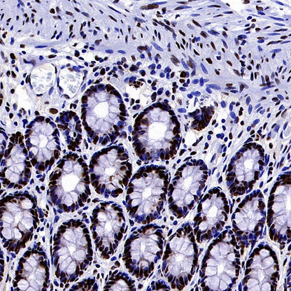 HAT1 Recombinant Rabbit mAb (S-2429-14)