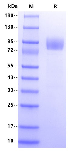Human SLP-76 Protein, His Tag
