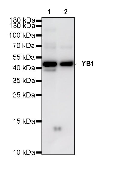 YB1 Recombinant Rabbit mAb (S-6245)