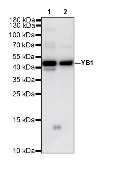 YB1 Recombinant Rabbit mAb (S-6245)