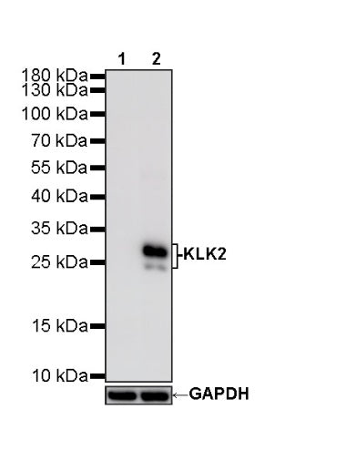 KLK2 Recombinant Rabbit mAb,PBS Only (SDT-4461-19)